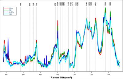 Testing Raman spectroscopy as a diagnostic approach for Lyme disease patients